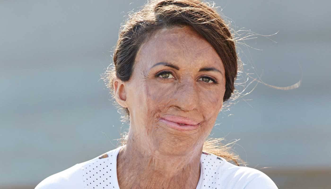 Turia Pitt 